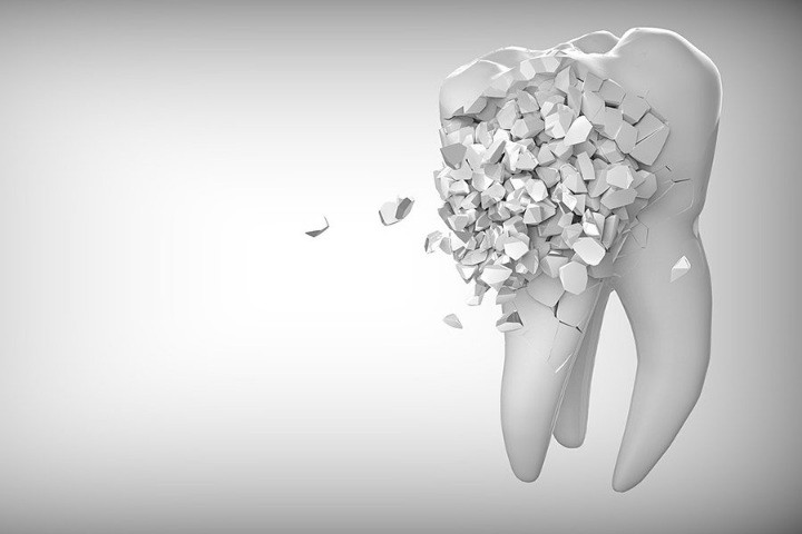 Потеря зубов может способствовать снижению когнитивных функций Потеря зубов может способствовать снижению когнитивных функций