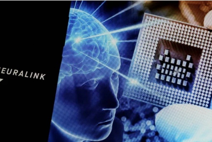 Маск пообещал начать массовый выпуск мозговых имплантов Маск пообещал начать массовый выпуск мозговых имплантов